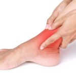 Sprained Ankle to Recover