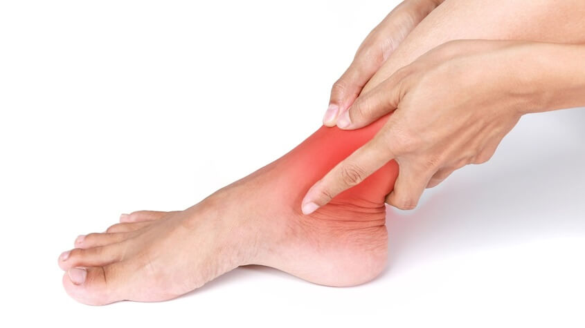 Sprained Ankle to Recover