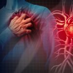 Heart Attack Prevention