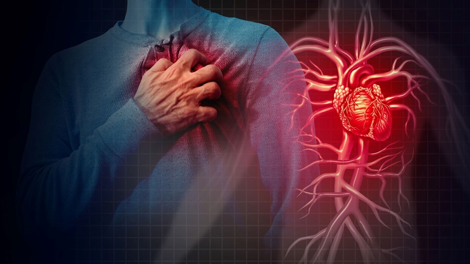Heart Attack Prevention