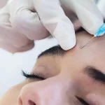 meso treatment